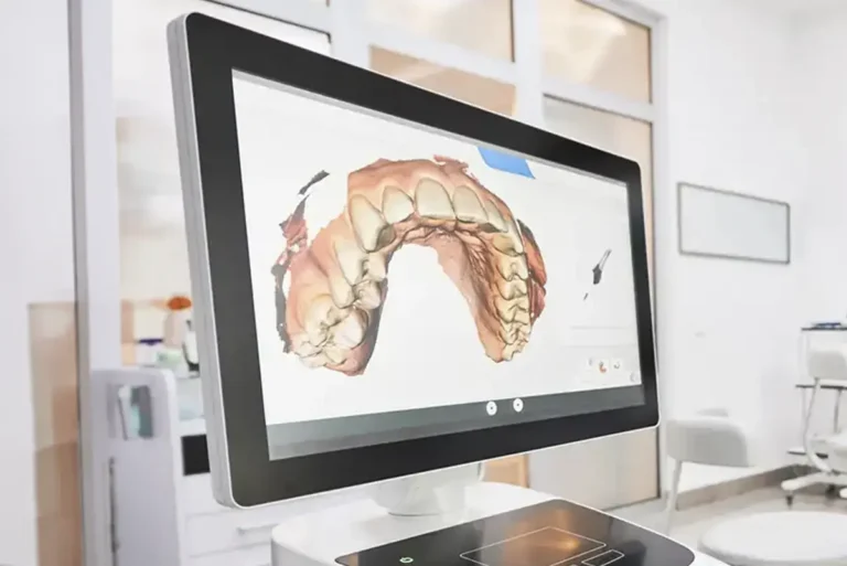 Intraoral scanner dental technology at Summit Dental Studio in Lee's Summit, MO.