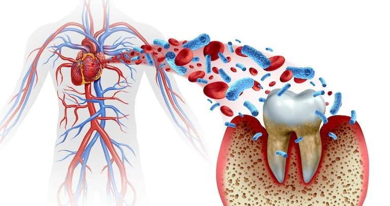 Oral Health and Heart Disease. Summit Dental Studio blog.